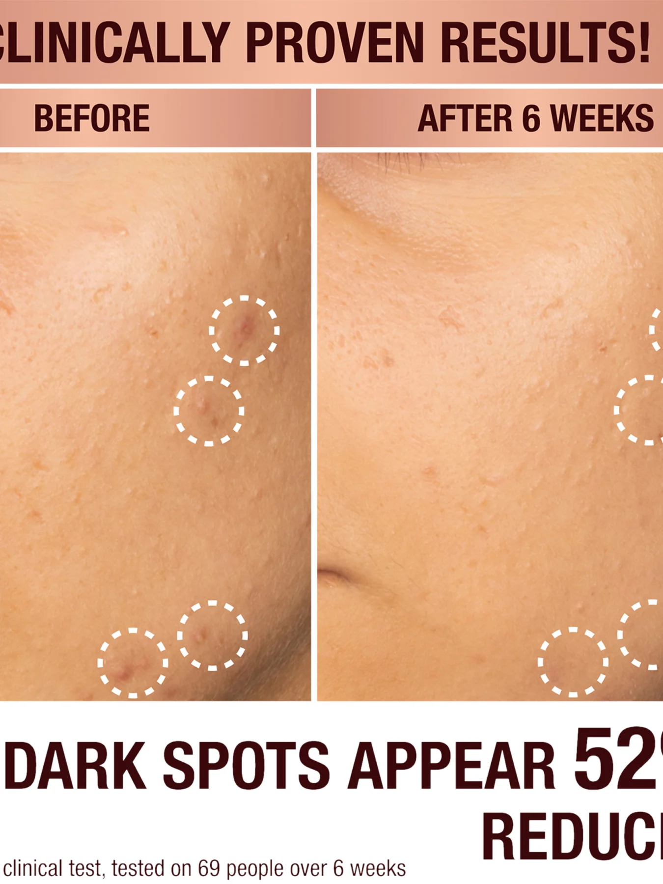 Dark Spot Correcting Radiance Recovery Serum 10ml - Image 3