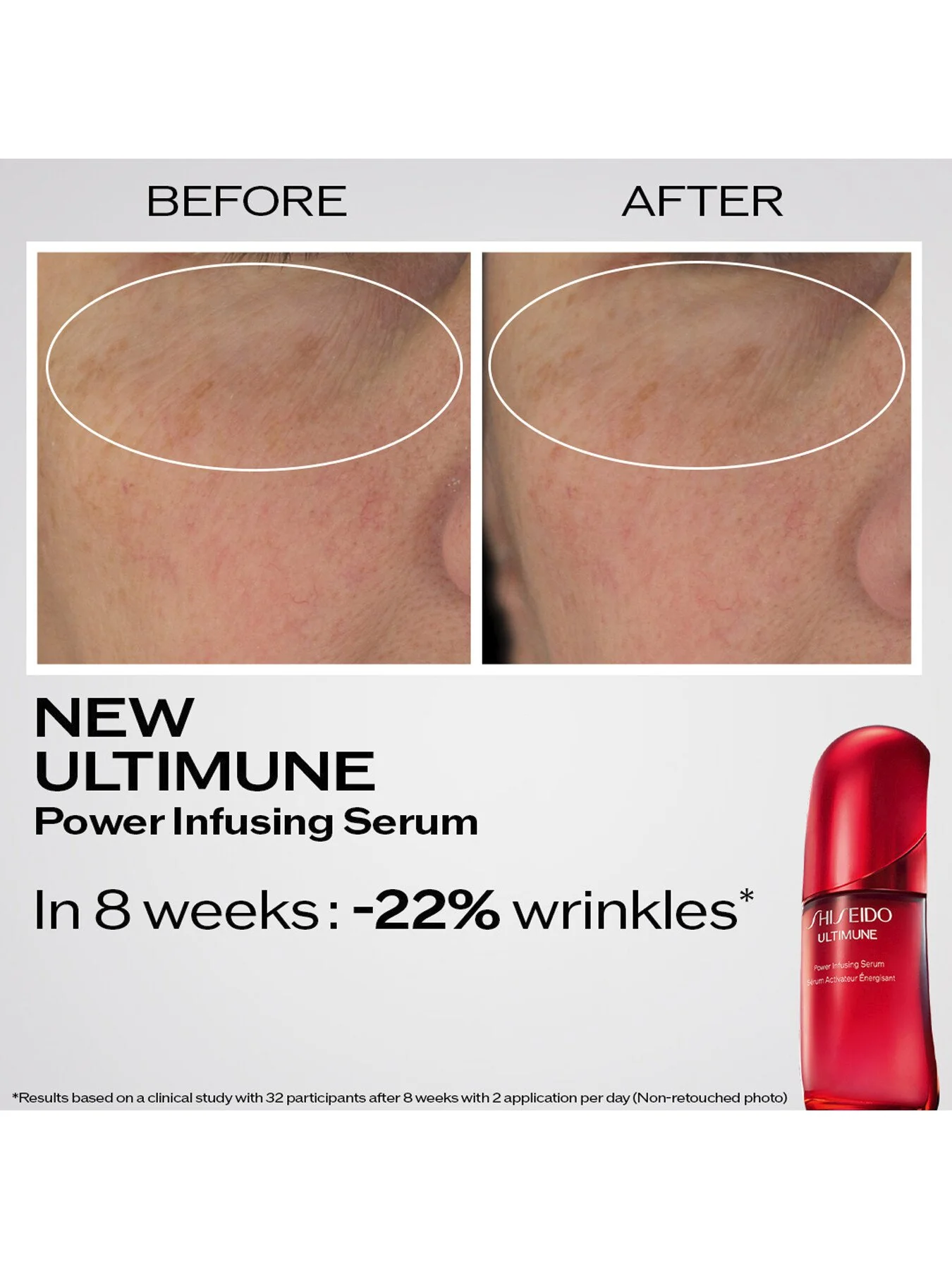 Ultimune Power Infusing Serum 75ml - Image 3