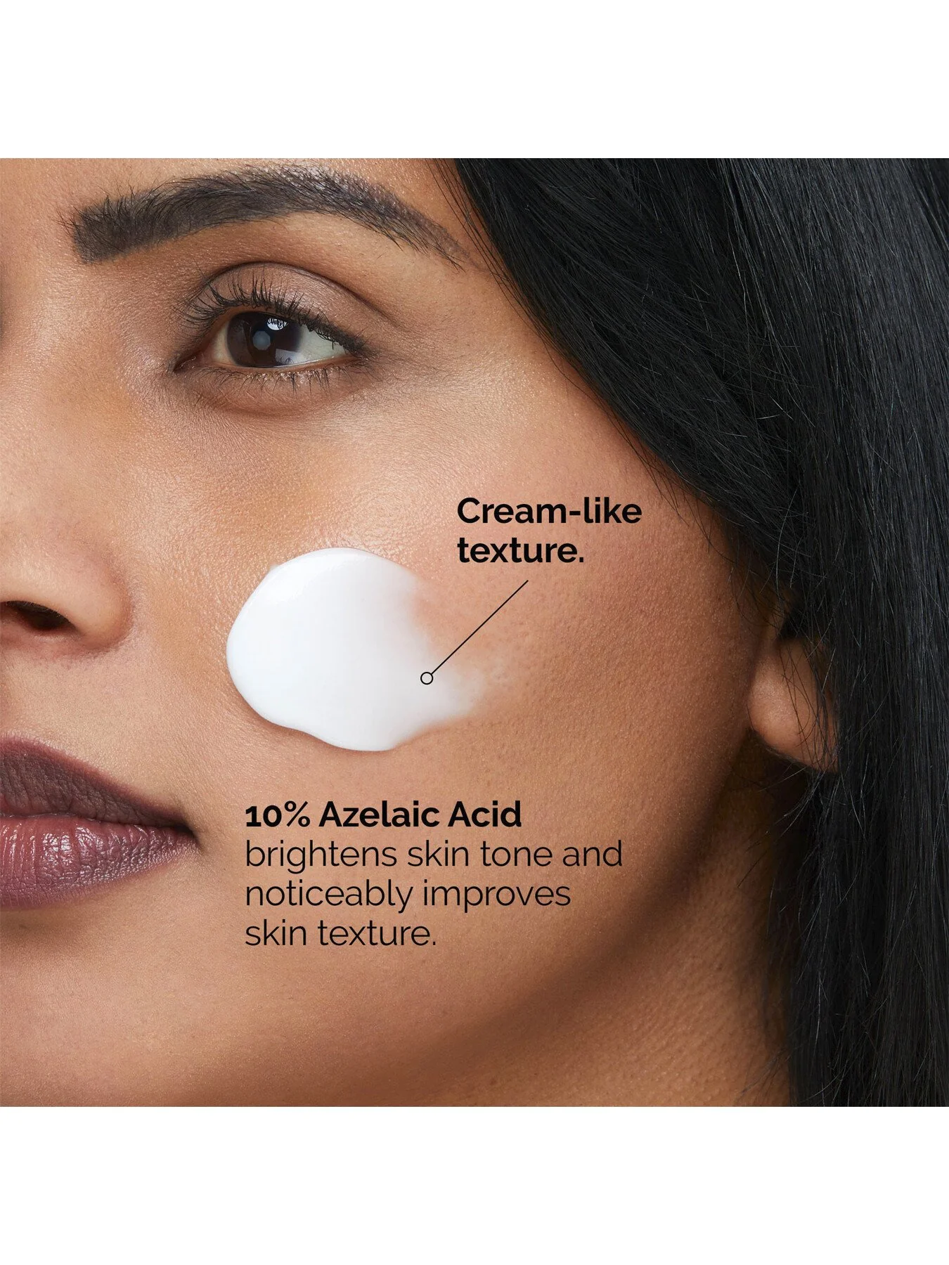 Azelaic Acid Suspension 10 100ml - Image 4