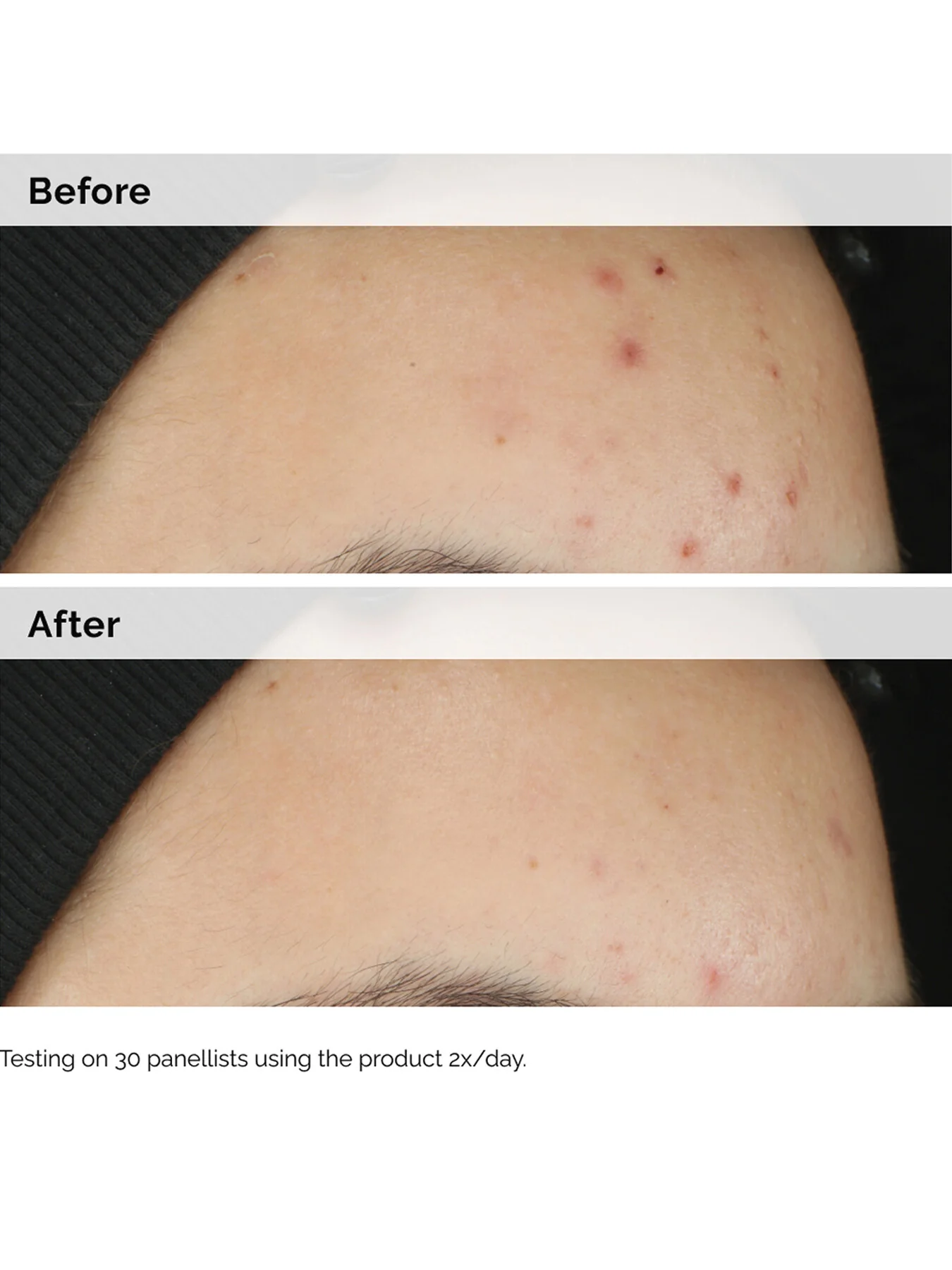 Balancing Clarifying Serum - Image 4