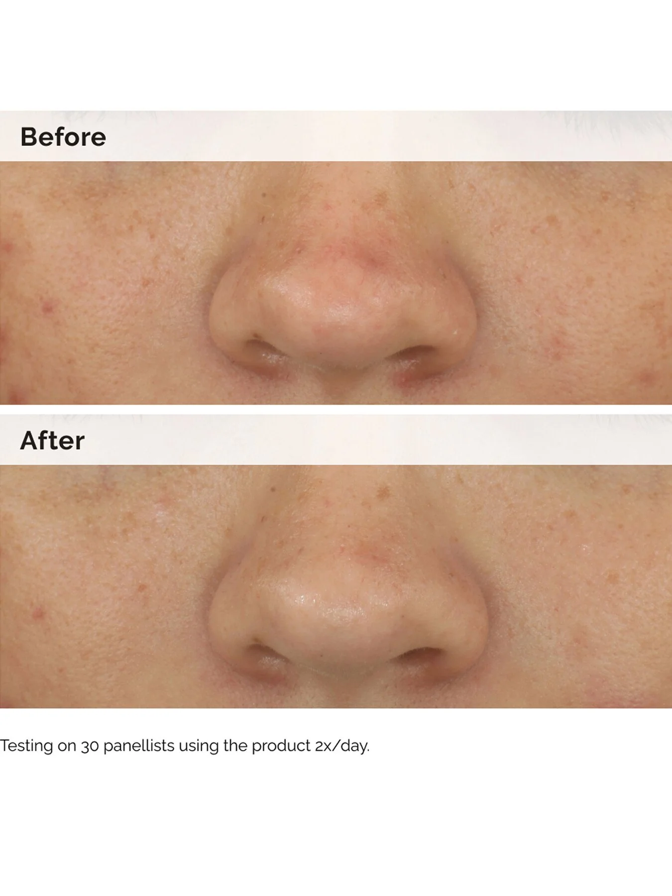 Balancing Clarifying Serum - Image 5