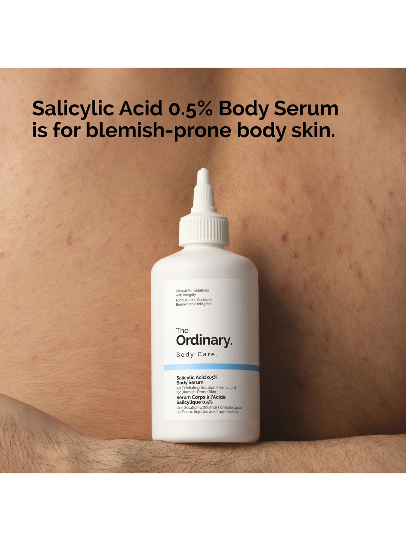 Salicylic Acid 0.5 Body Serum 240ml - Image 4