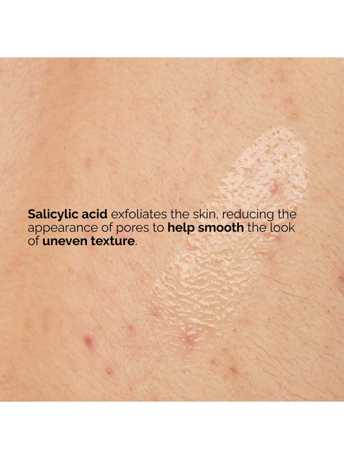 Salicylic Acid 0.5 Body Serum 240ml - Image 5