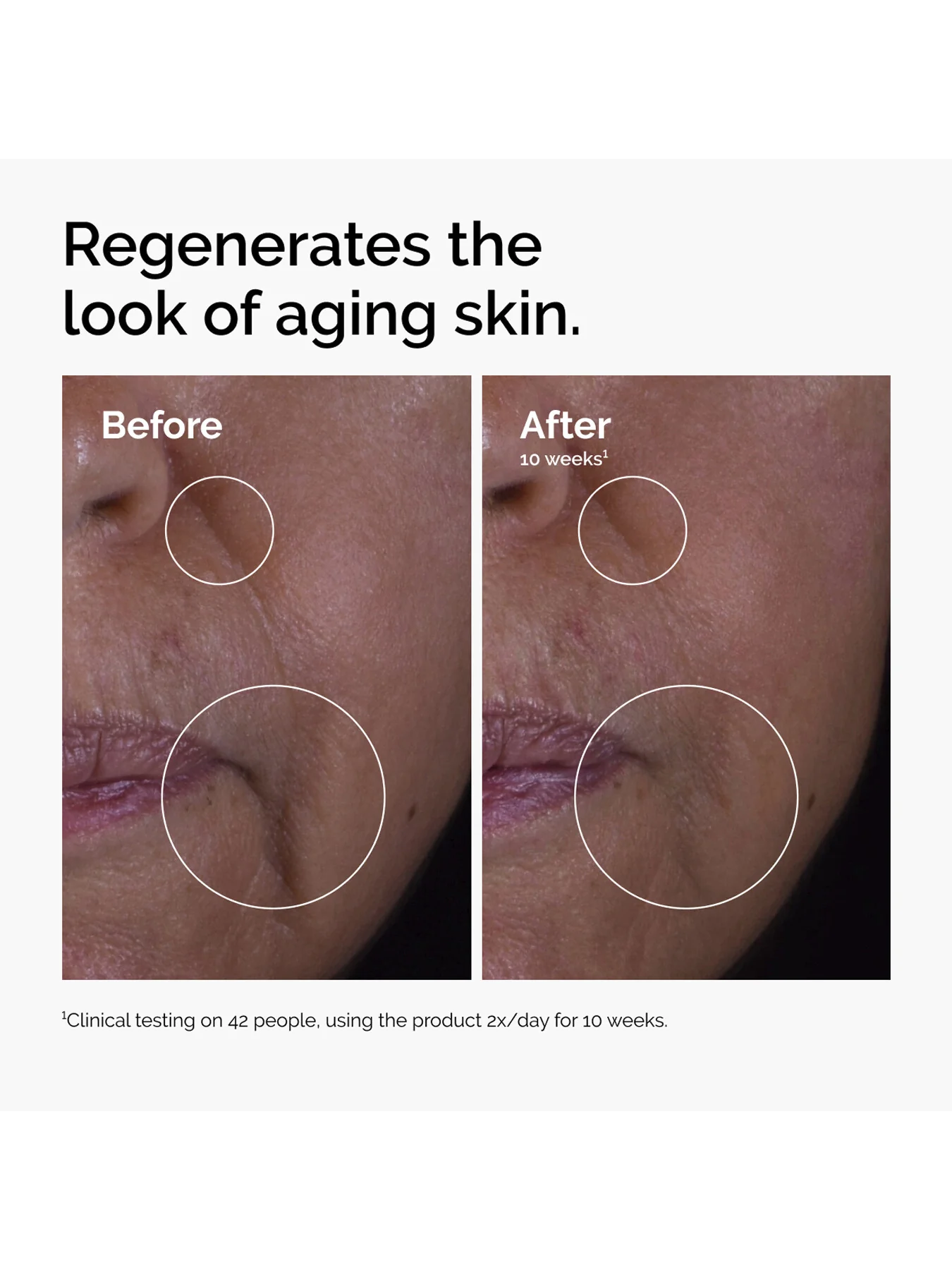The Ordinary GF 15% Solution - Image 4